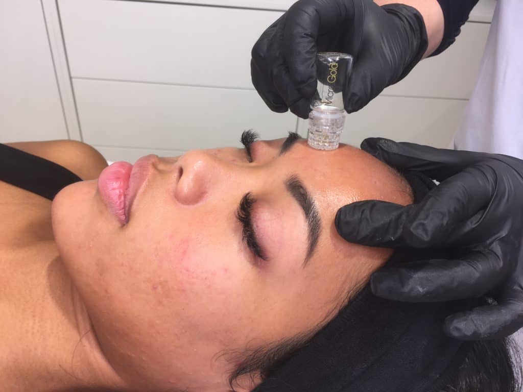 microgold behandling microtox københavn
